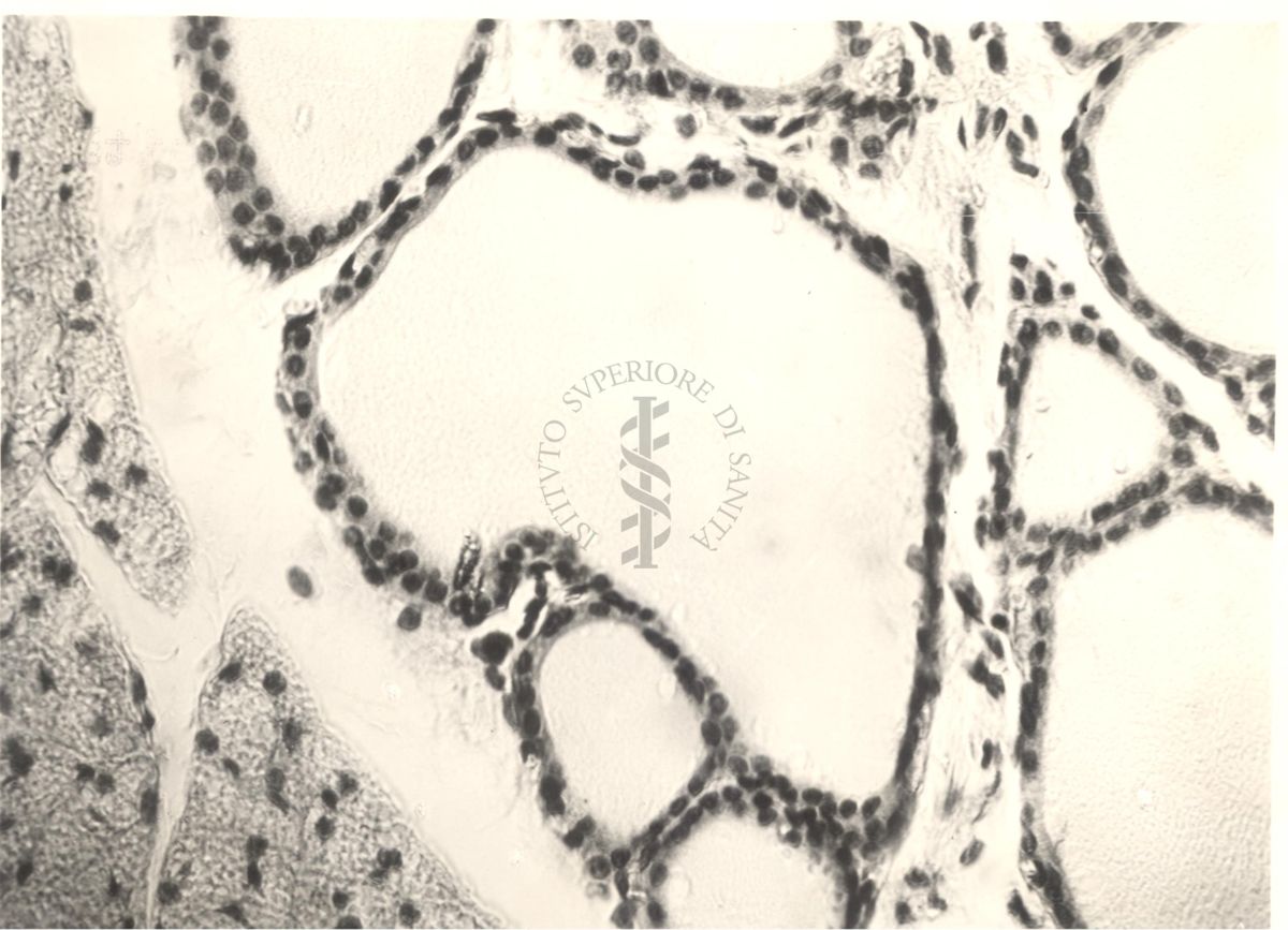 Immagine da microscopio che mostra l'azione del fluoro sulla tiroide in animali normali ed iposectomizzati