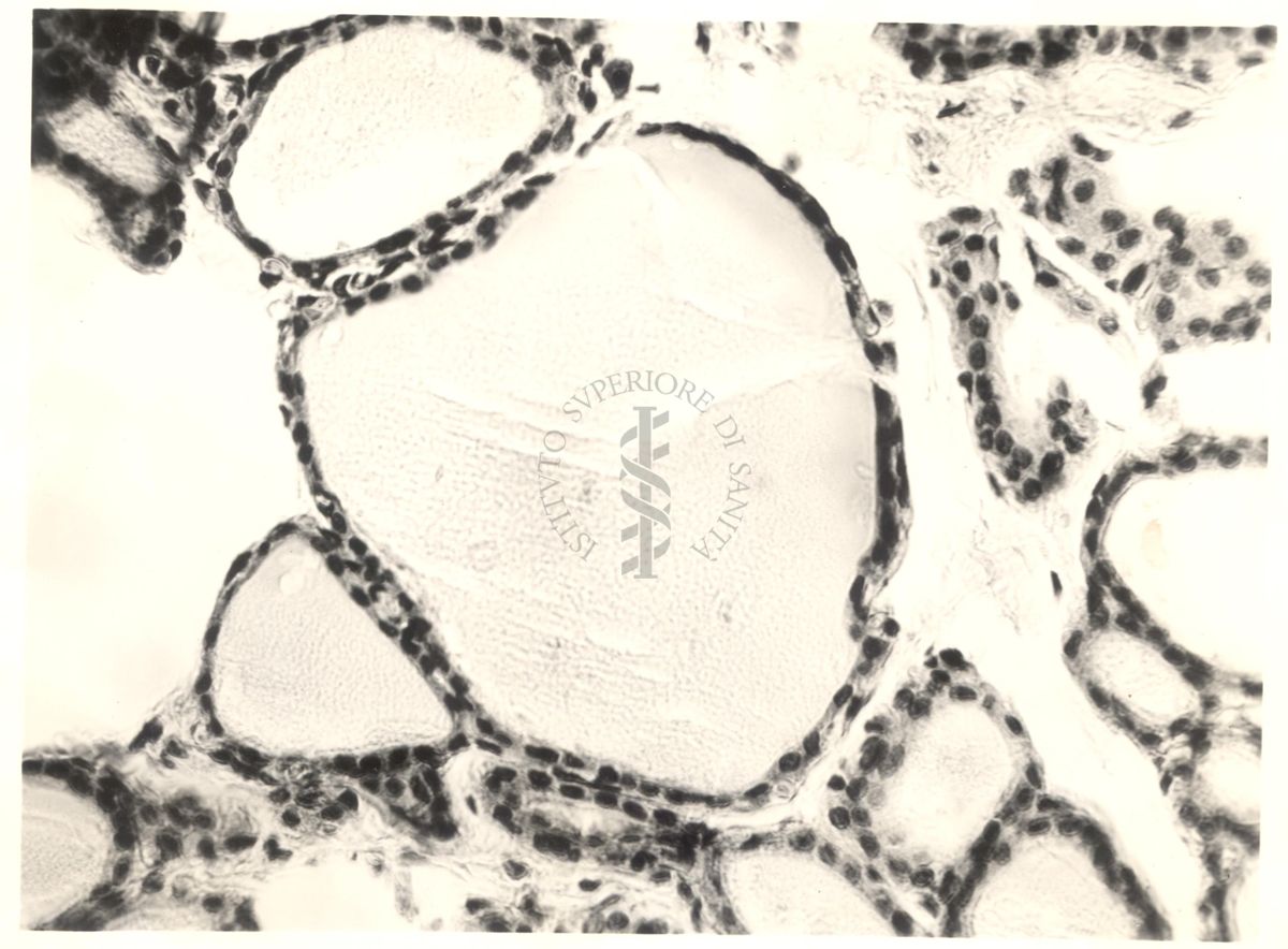 Immagine da microscopio che mostra l'azione del fluoro sulla tiroide in animali normali ed iposectomizzati