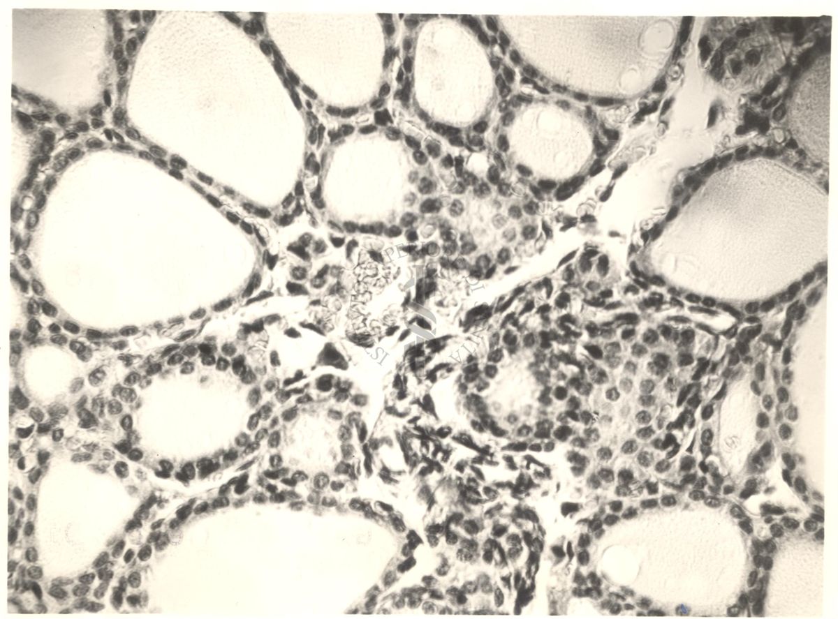 Immagine da microscopio che mostra l'azione del fluoro sulla tiroide in animali normali ed iposectomizzati