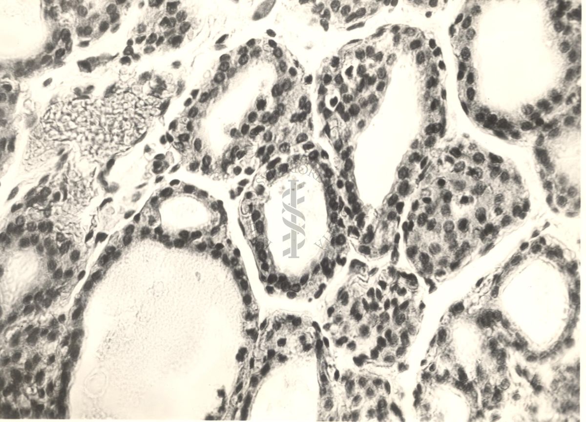 Immagine da microscopio che mostra l'azione del fluoro sulla tiroide in animali normali ed iposectomizzati