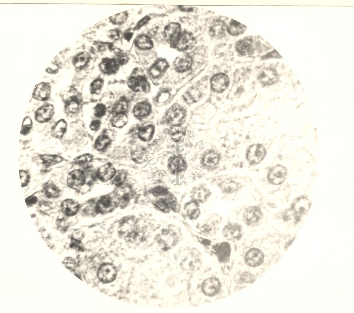 Immagine al microscopio di Cromalina del sesso in cellule di tessuti di piccione