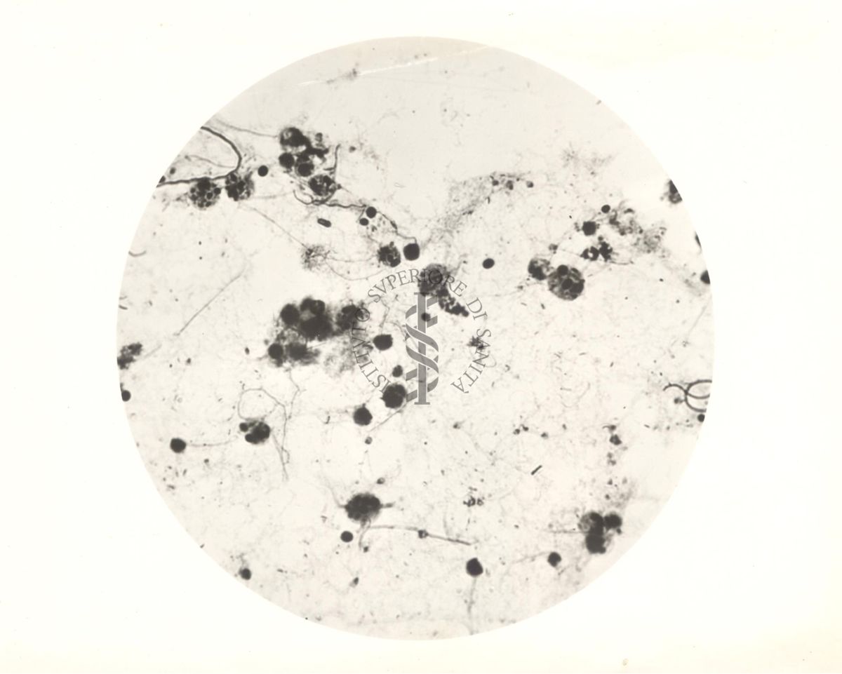 Immagine al microscopio di protozoi dell'ampolla cecale del Calctermes (termite)