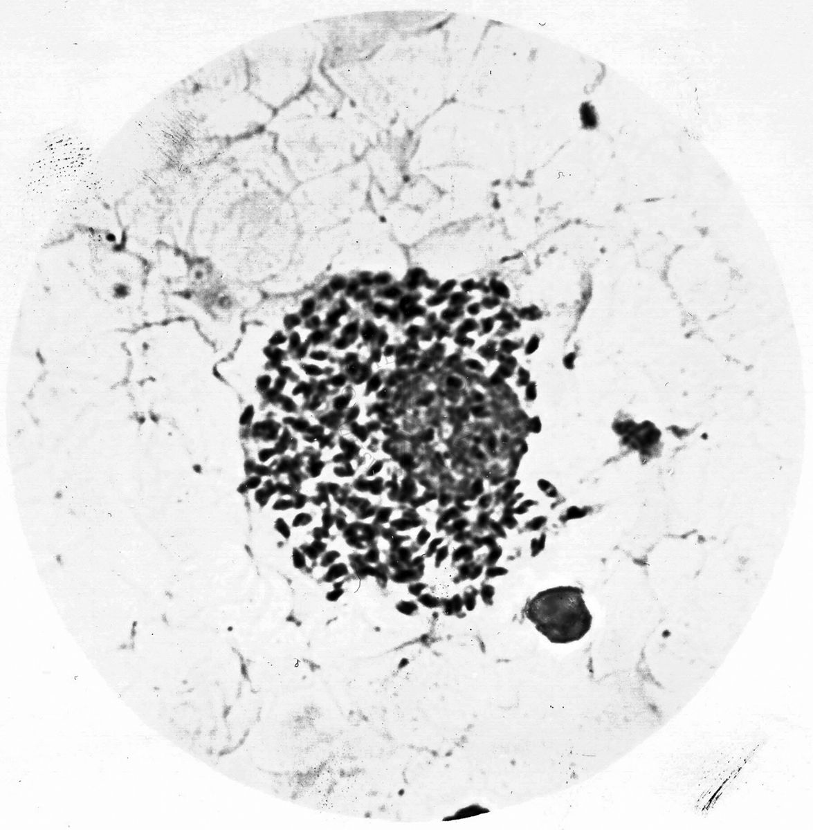 Leishmania tropica-Leishmanie libere e nel citoplasma di cellule reticolo endoteliali (lesione cutanea umana) Abruzzi