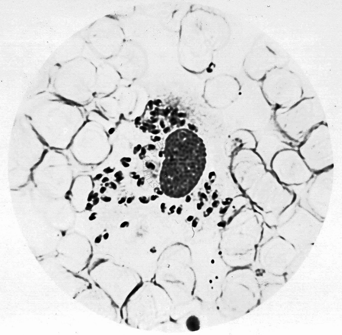 Leishmania tropica nel bottone d'Oriente umano (Abruzzo)