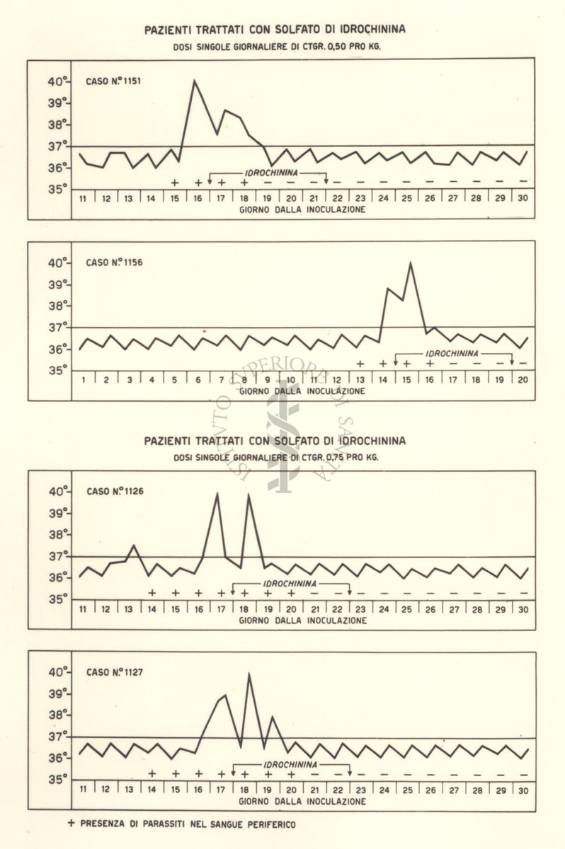 Sequenza di 4 grafici di pazienti trattati con Solfato di Idrochinina, con dosi singole giornaliere di ctgr 0,50 e 0,75 pro Kg