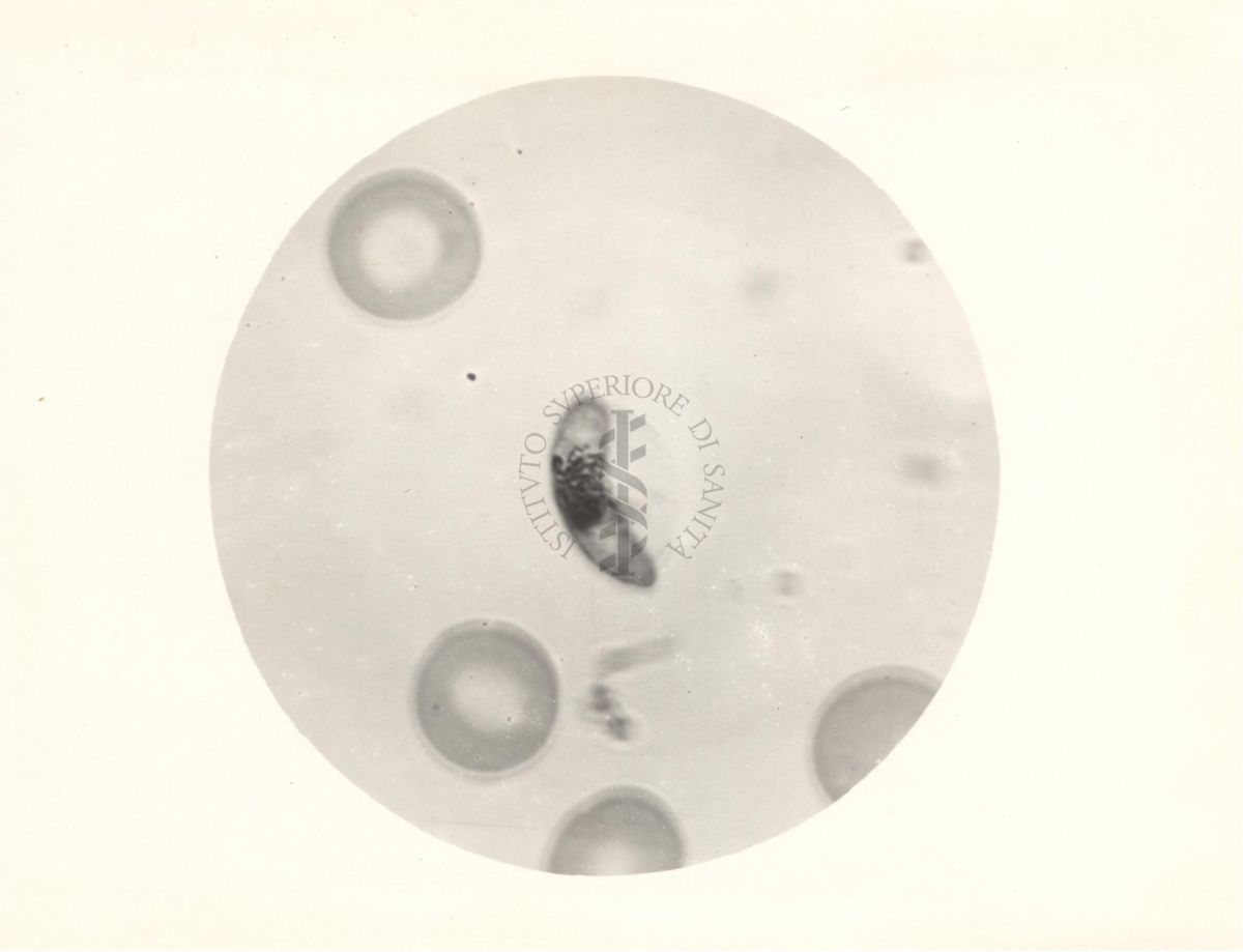 Macrogametocita del Plasmodium falciparum