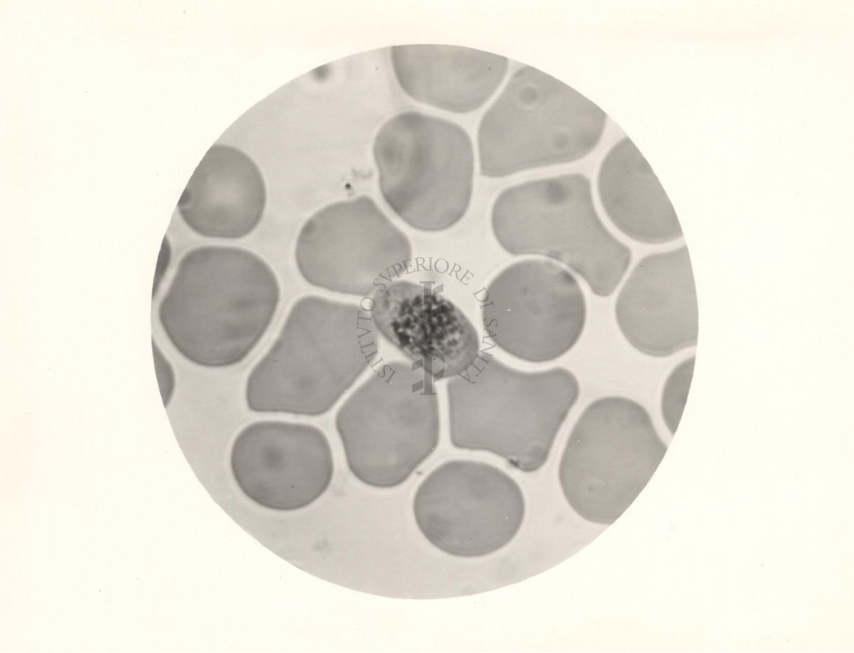 Microgametocita del Plasmodium falciparum