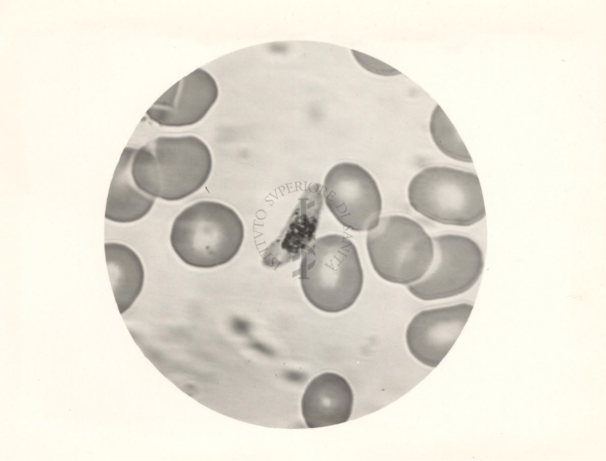 Semiluna del Plasmodium falciparum