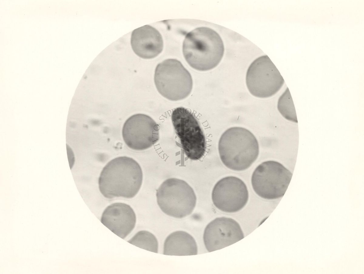 Semiluna del Plasmodium falciparum