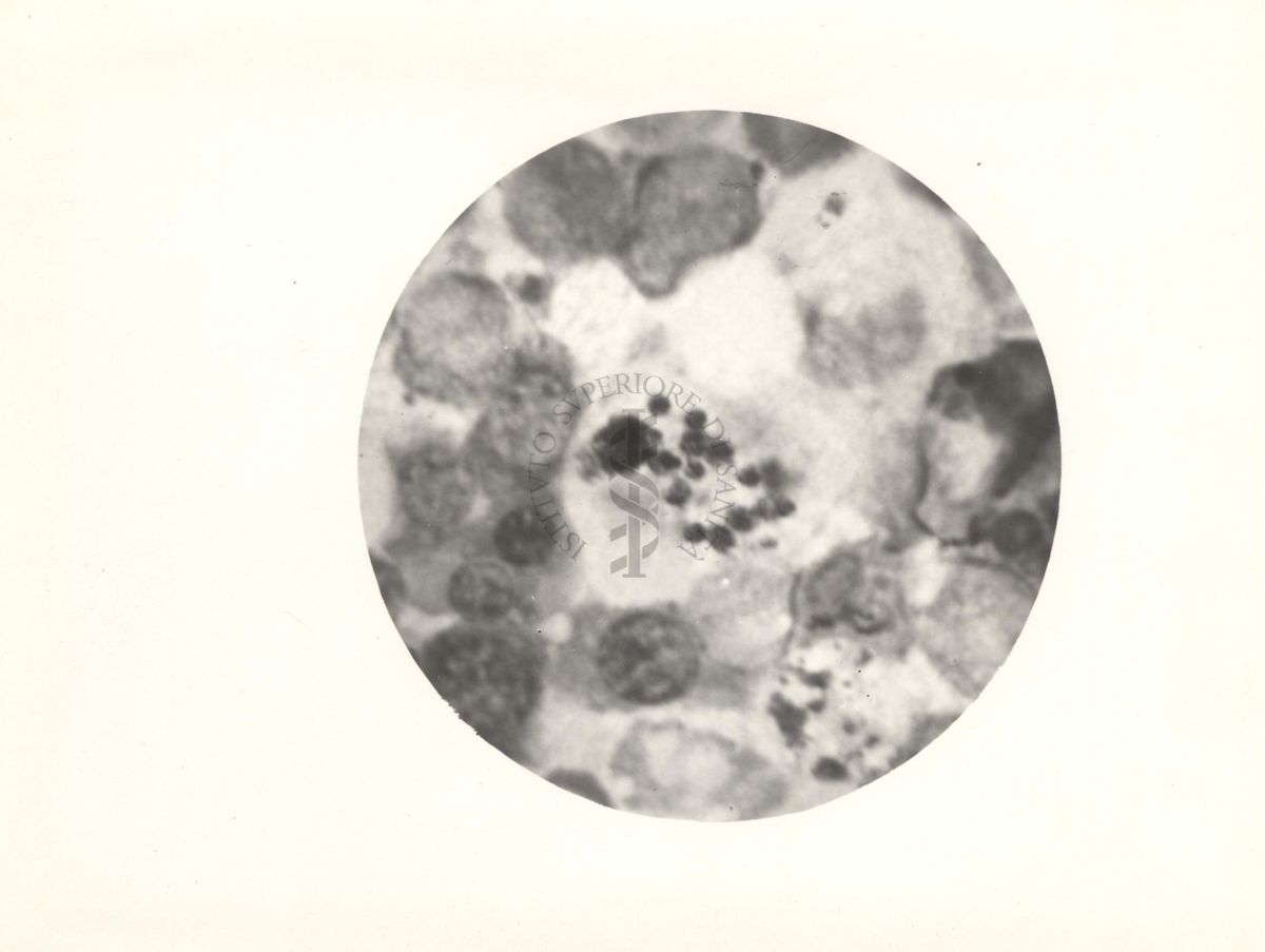 Fagocitosi del pigmento da parte di cellule reticolo endoteliali (midollo osseo) nell'infezione da Plasmodium gallinaceum