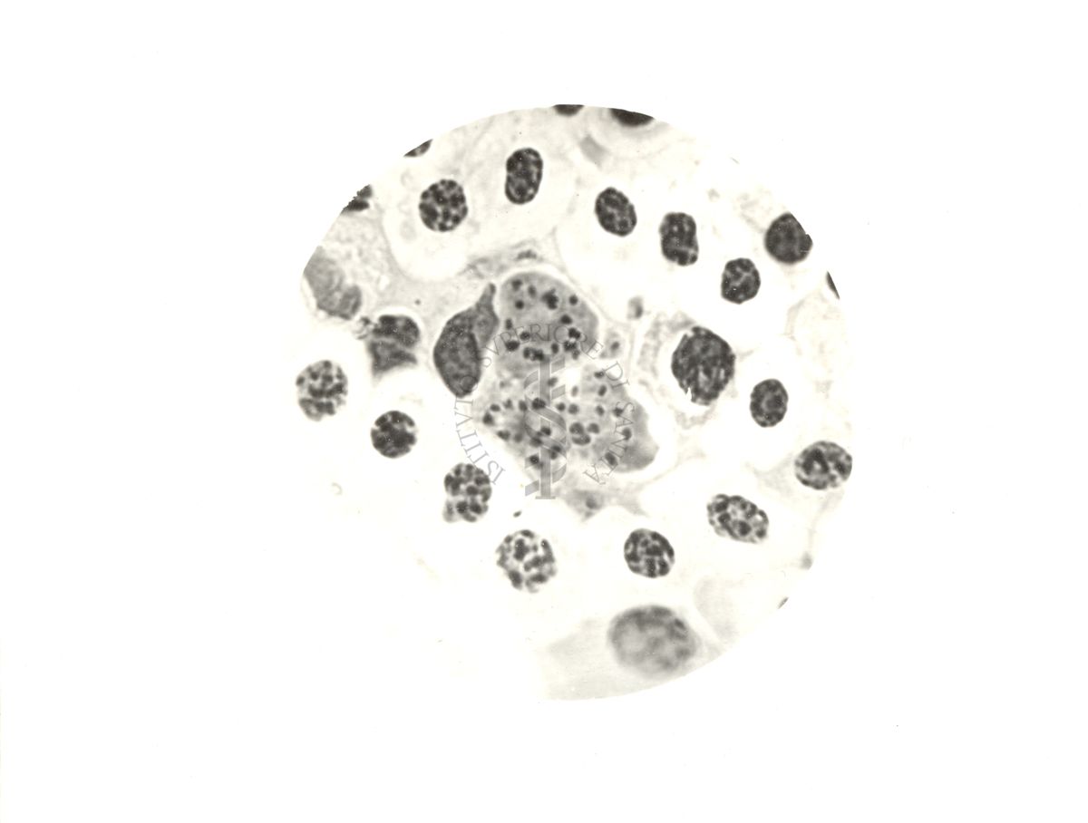 Plasmodium gallinaceum: sviluppo sviluppo endo istiocitario del parassita (midollo osseo)