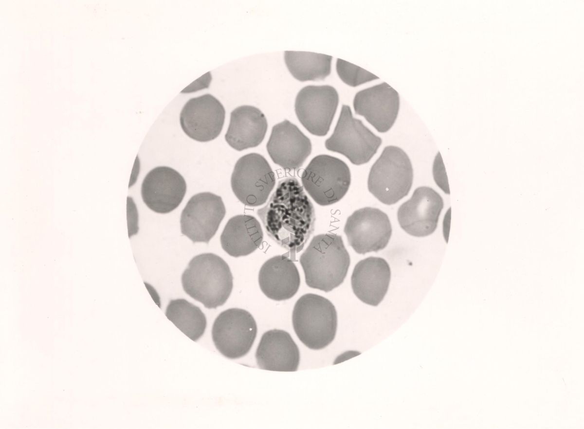 Plasmodium vivax. Trofozoite adulto