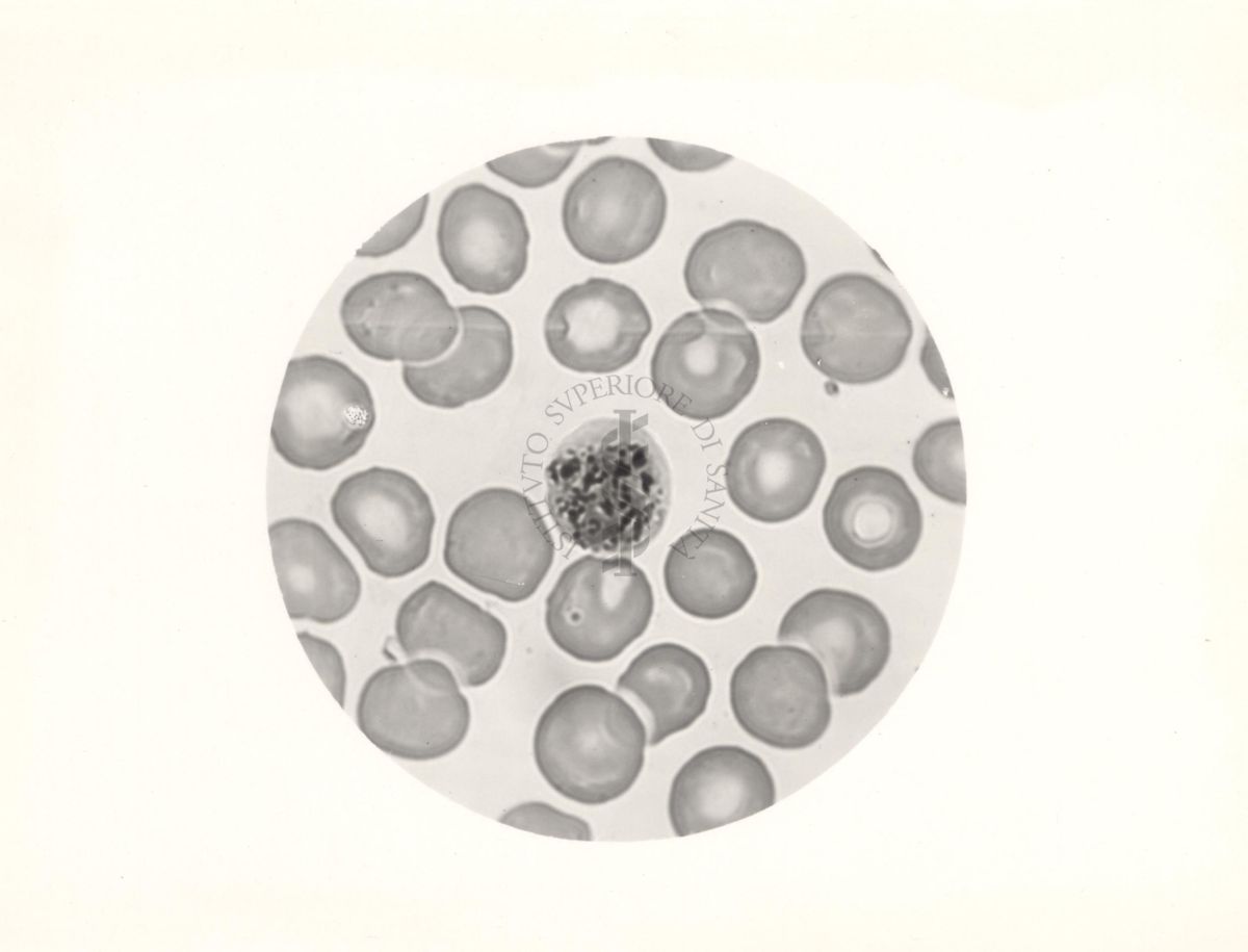 Plasmodium vivax. Schizonte con 8 nuclei