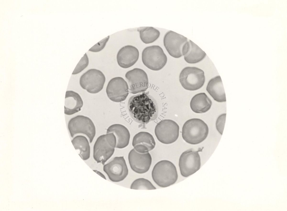 Plasmodium vivax. Schizonte con 4 nuclei