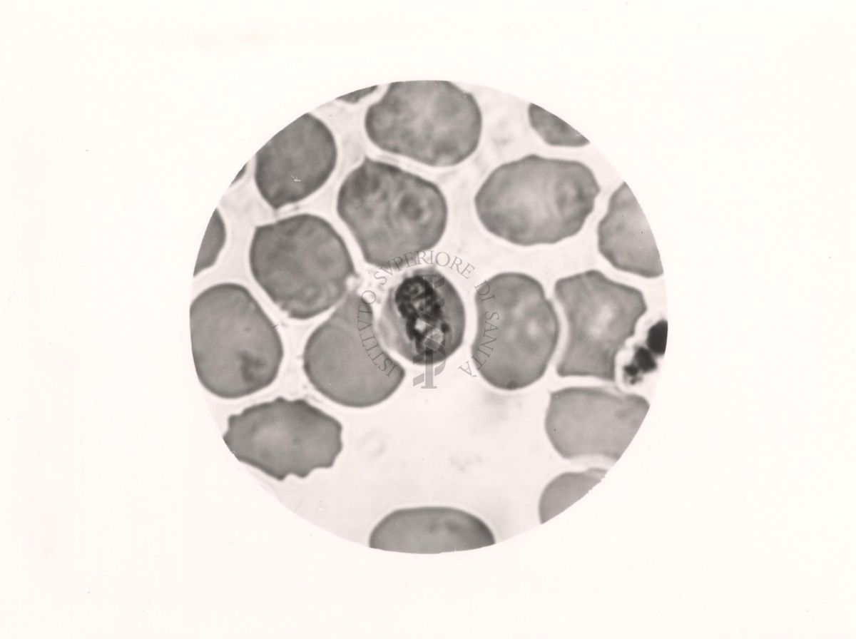Plasmodium malariae. Schizonte