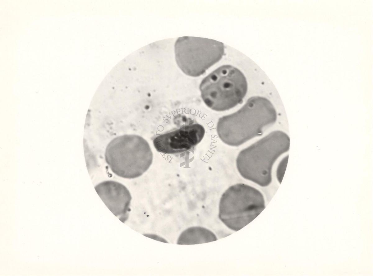 Plasmodium falciparum. Macrogametocito