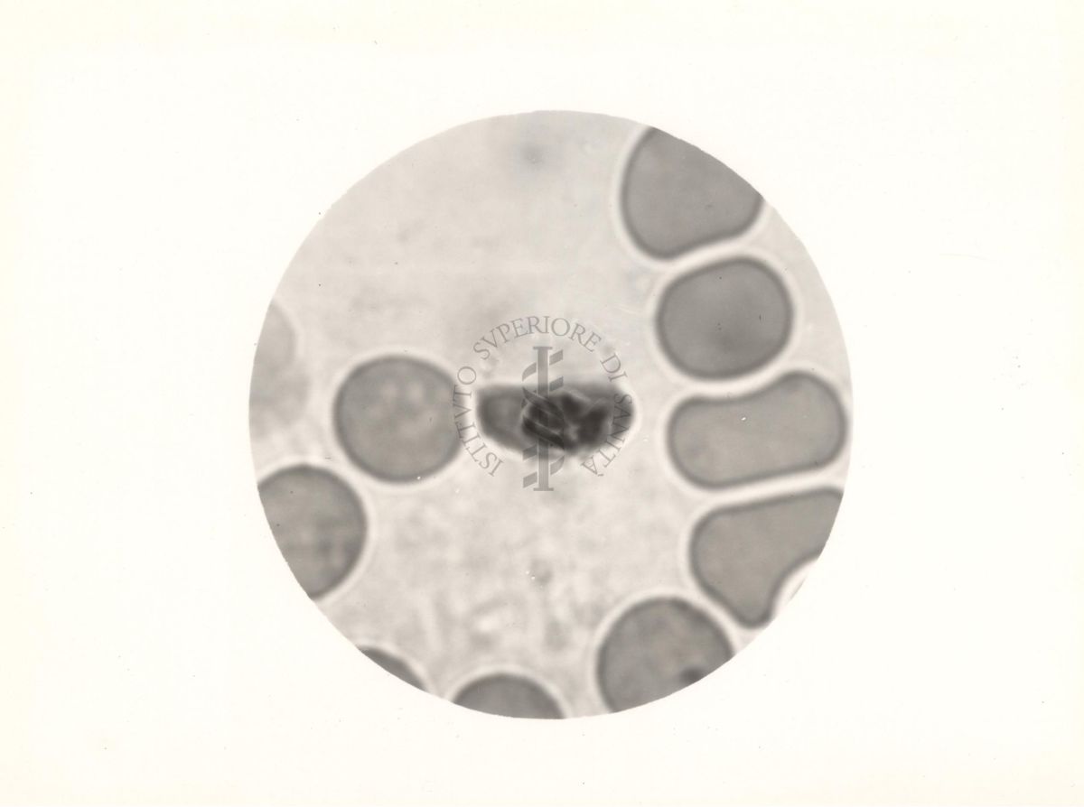 Plasmodium falciparum. Microgametocito
