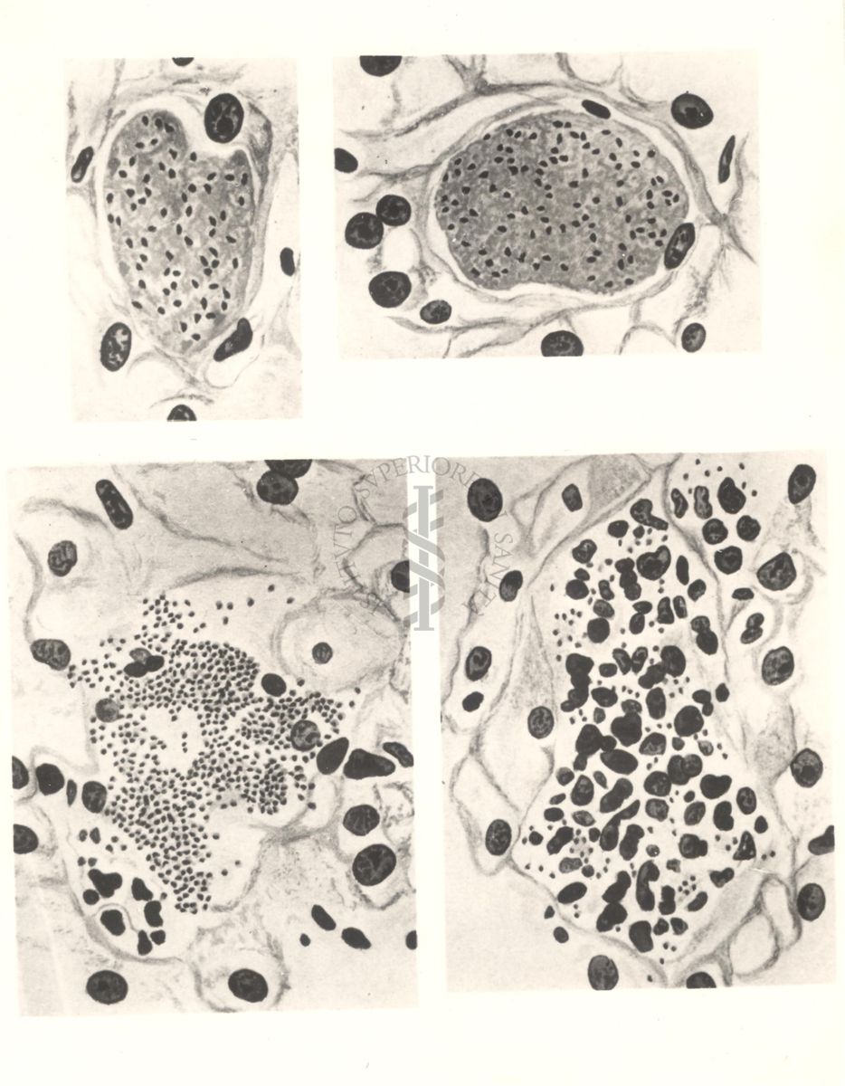 Sequenza di 4 immagini di Schizonti del Plasmodium cynomolgi