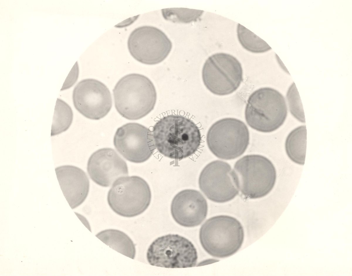 Ciclo sessuale nel sangue dell'uomo del Plasmodium vivax