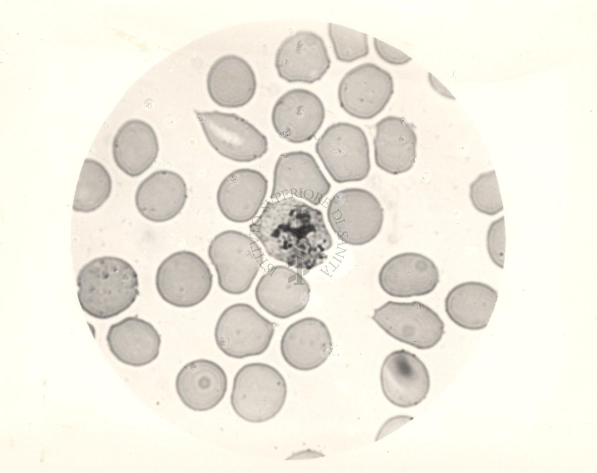 Ciclo sessuale nel sangue dell'uomo del Plasmodium vivax