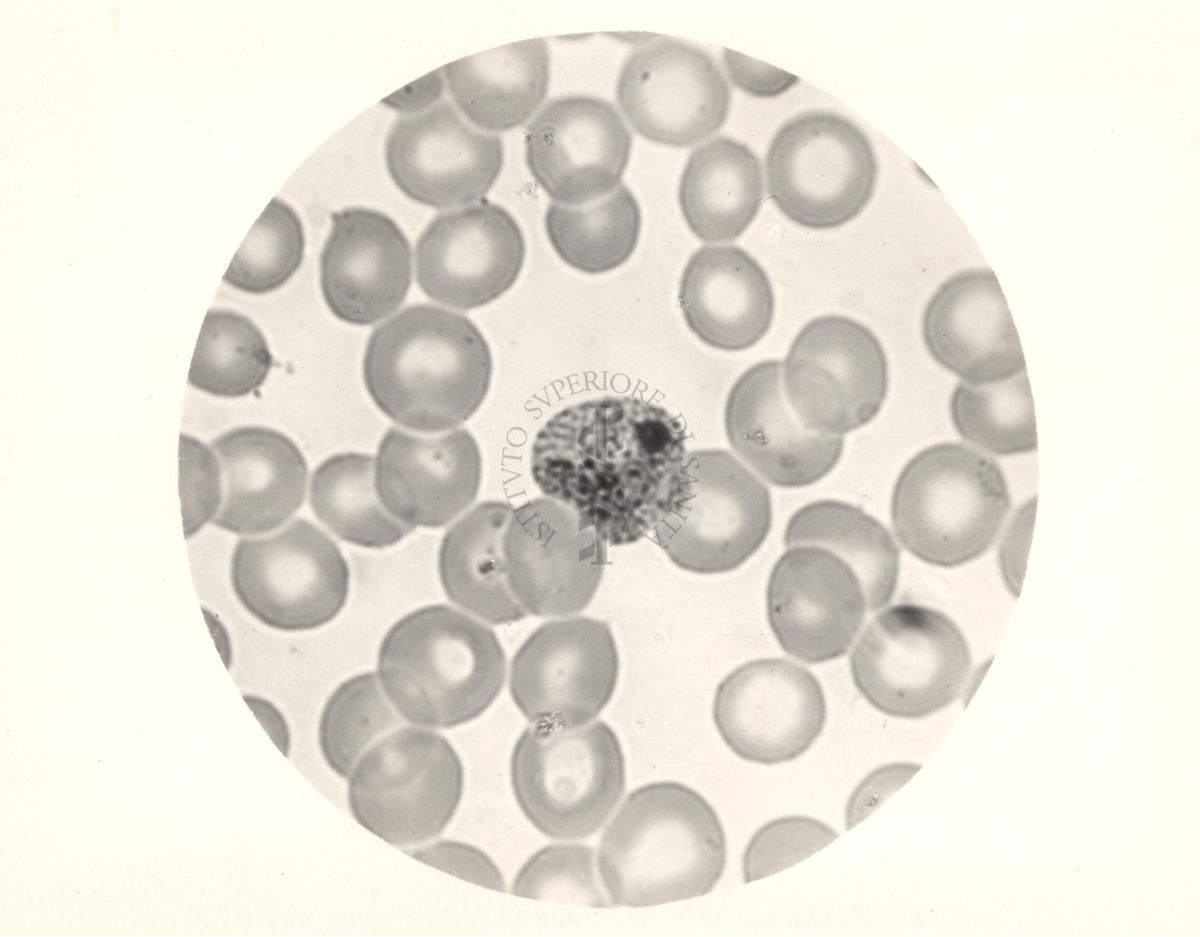 Ciclo sessuale nel sangue dell'uomo del Plasmodium vivax