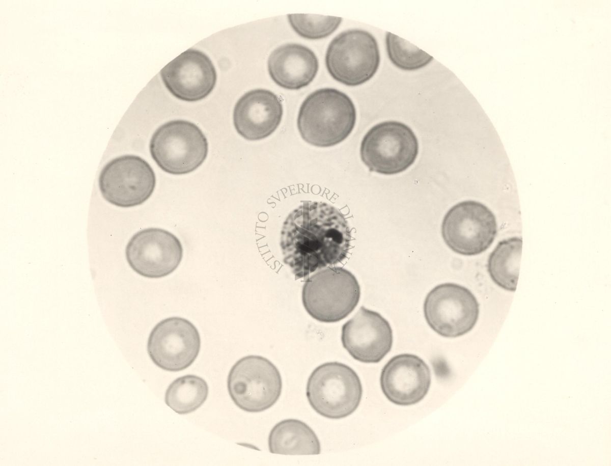 Ciclo sessuale nel sangue dell'uomo del Plasmodium vivax