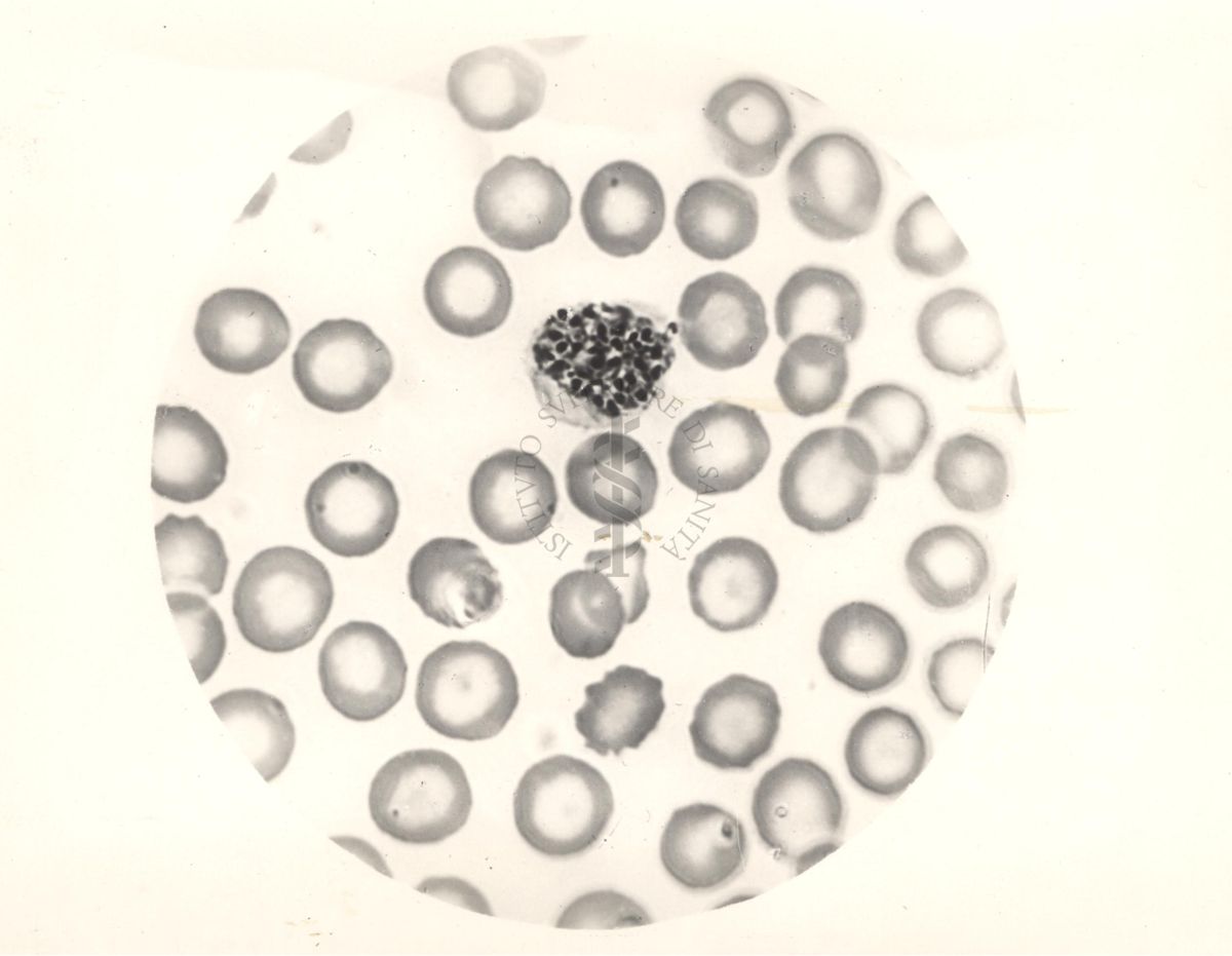 Ciclo sessuale nel sangue dell'uomo del Plasmodium vivax