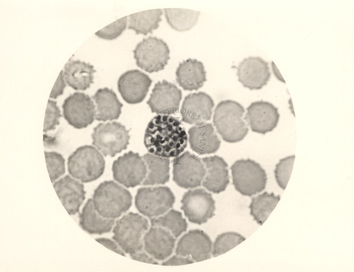 Ciclo sessuale nel sangue dell'uomo del Plasmodium vivax