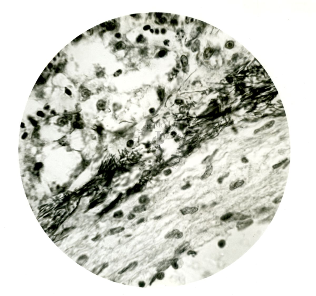 Infezione sperimentale da Proteus vulgaris: Fasci di Protei nel fegato di una carpa
