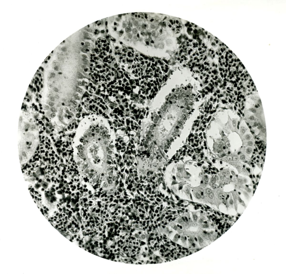 Infezione sperimentale da Proteus vulgaris: Emorragie renali in una carpa