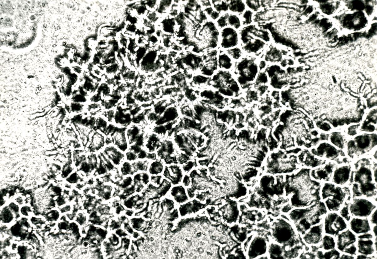 Coltura in piastra di agar di fermento lattico