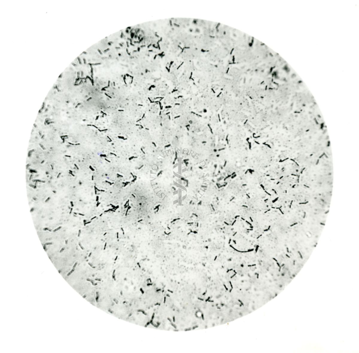 Preparato microscopico di bacillo acidofilo