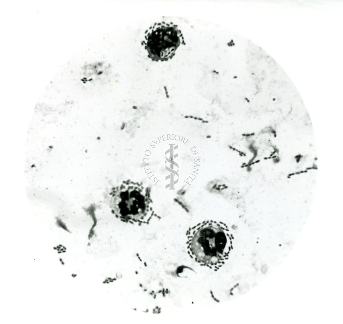 Pneumococco: essudato di topini