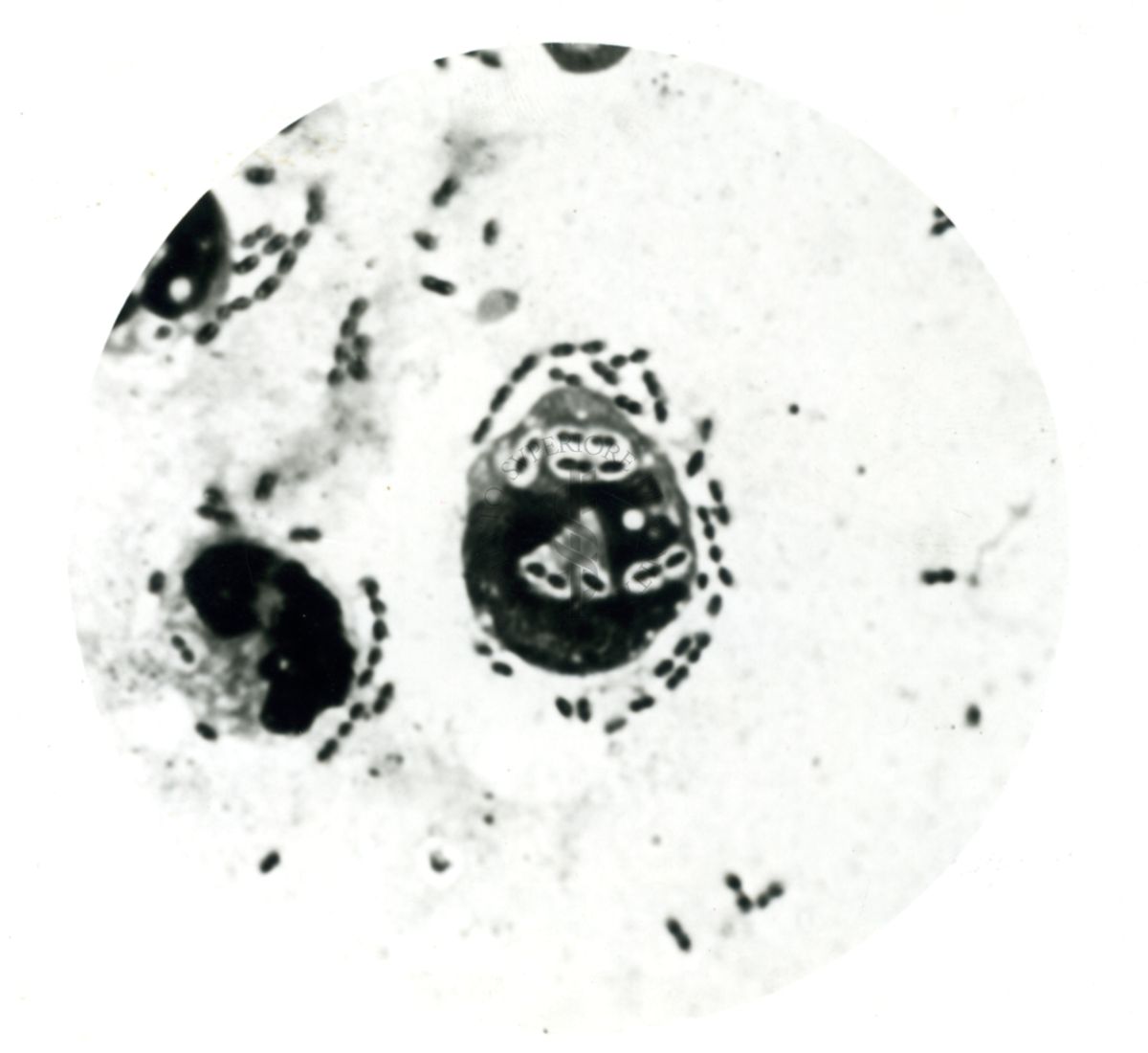 Pneumococco: essudato di topini