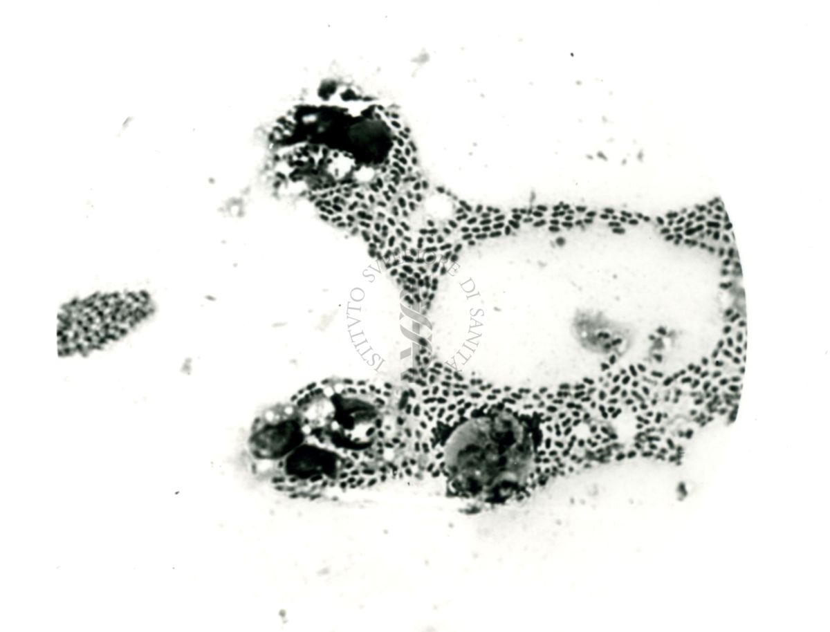 Pneumococco: essudato di topino