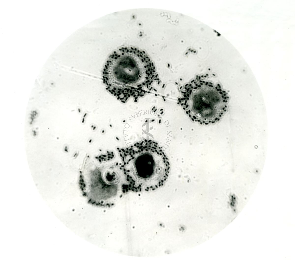 Pneumococco: essudato di topino