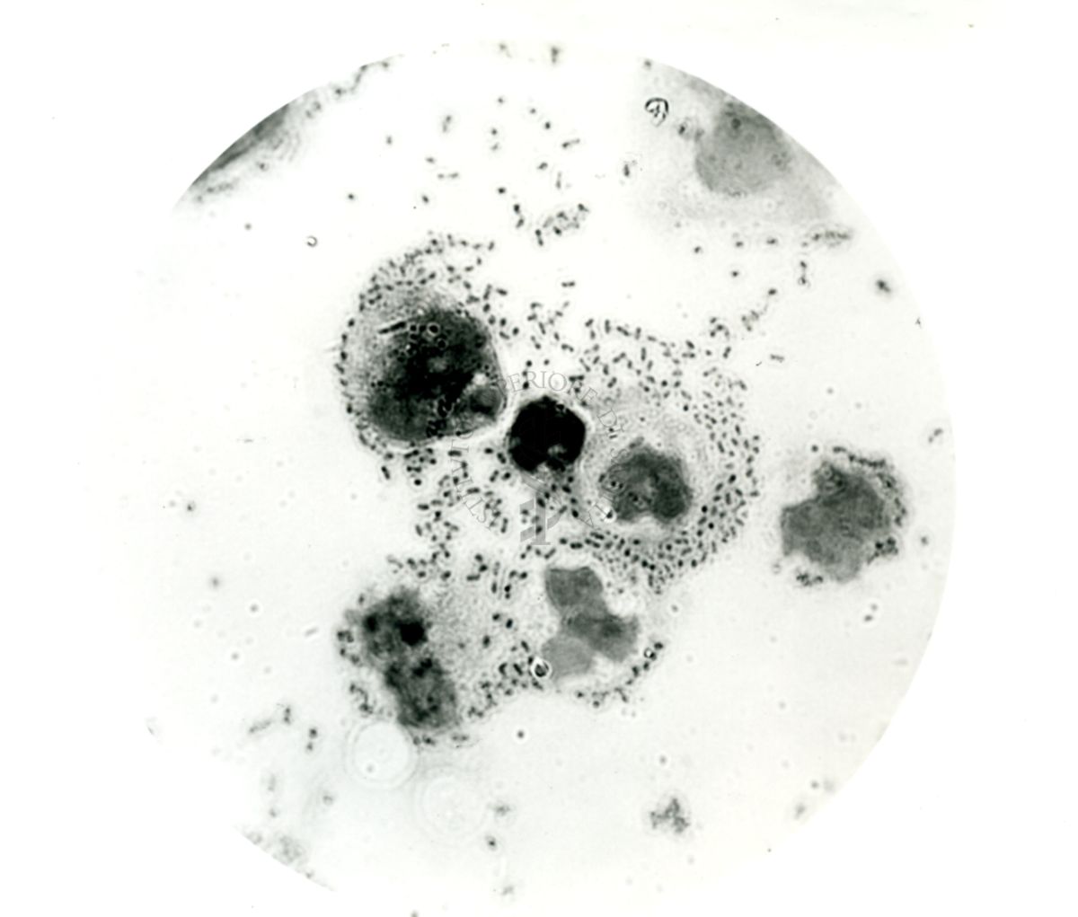 Pneumococco: essudato di topini