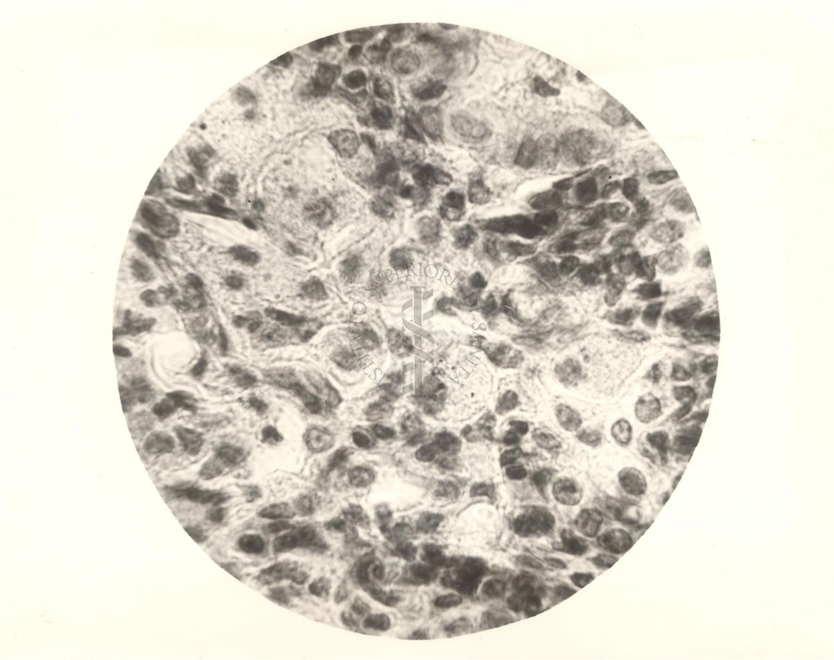 Organo di topo inoculato con tubercolina