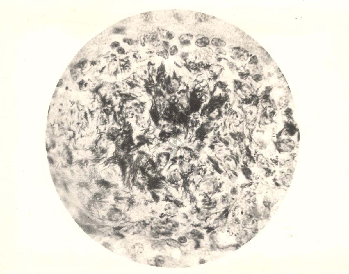 Organo di topo inoculato con tubercolina