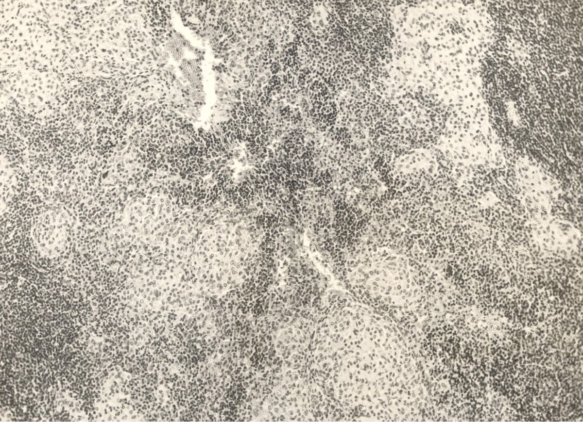 Organo di topo inoculato con tubercolina