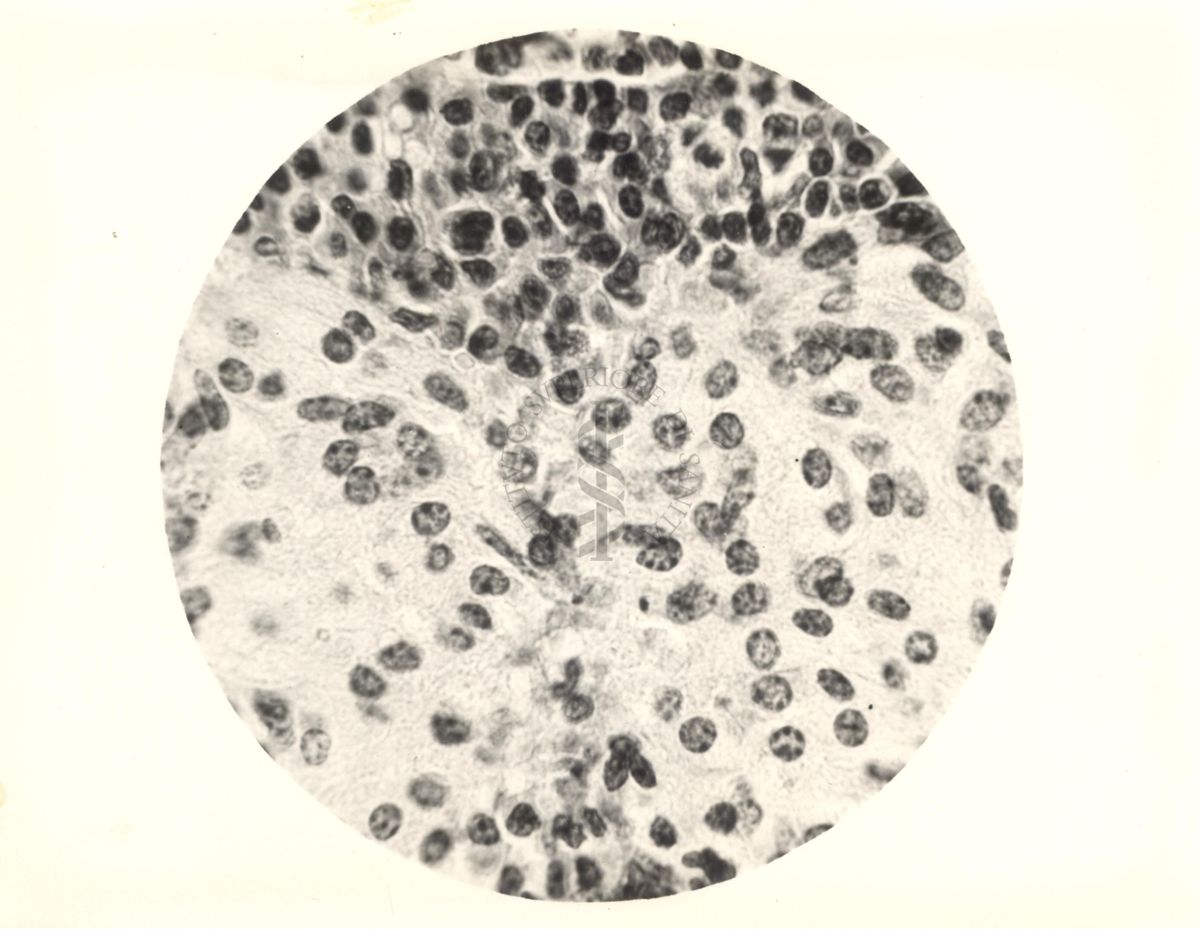 Organo di topo inoculato con tubercolina