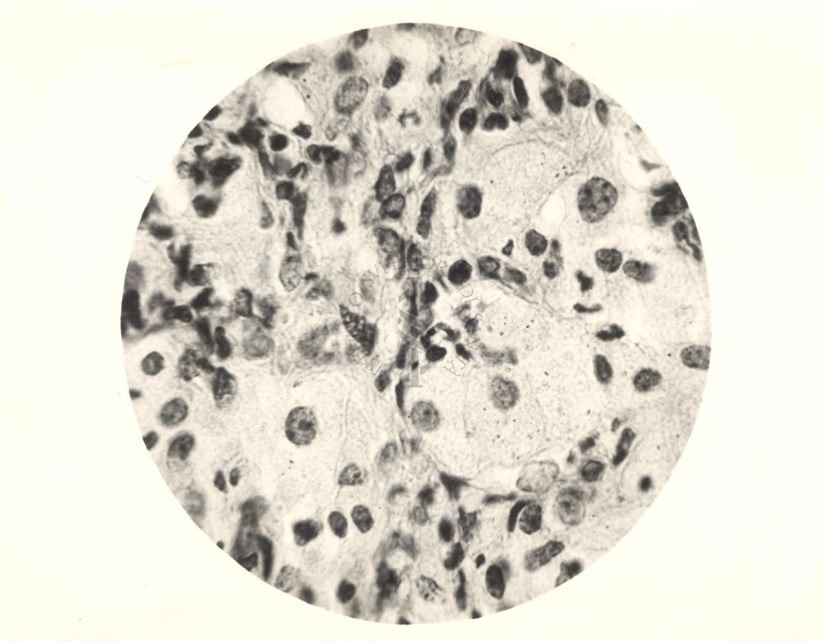 Organo di topo inoculato con tubercolina