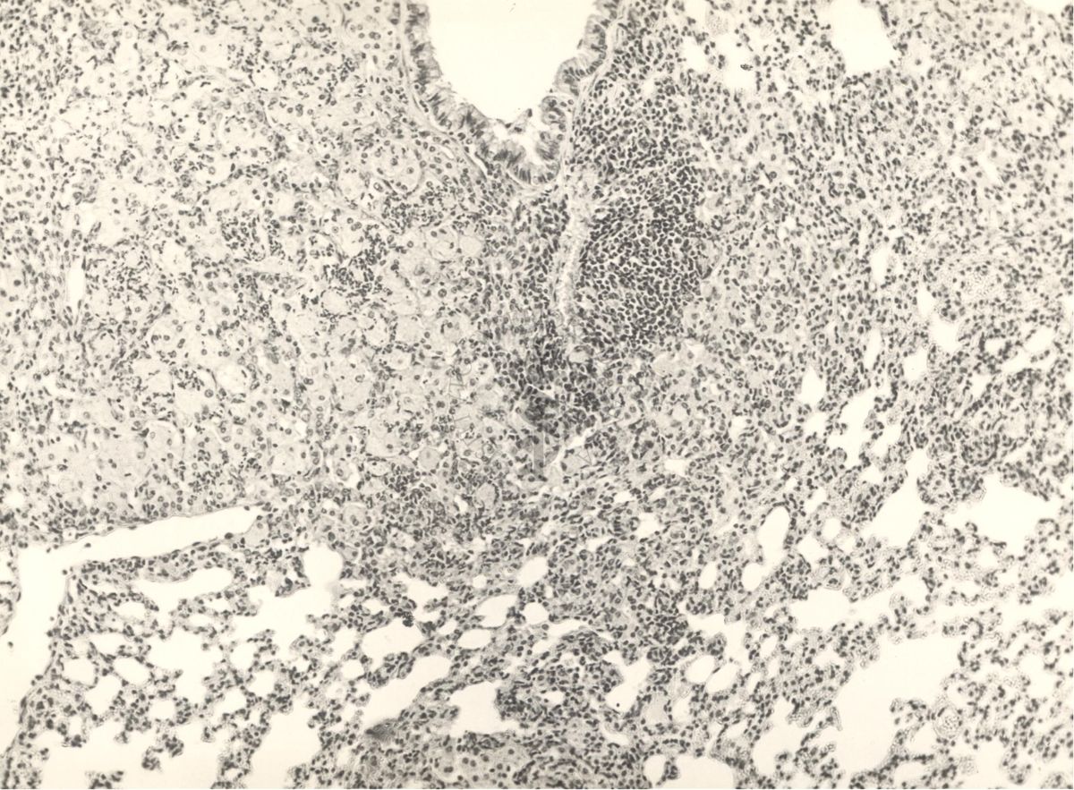 Organo di topo inoculato con tubercolina