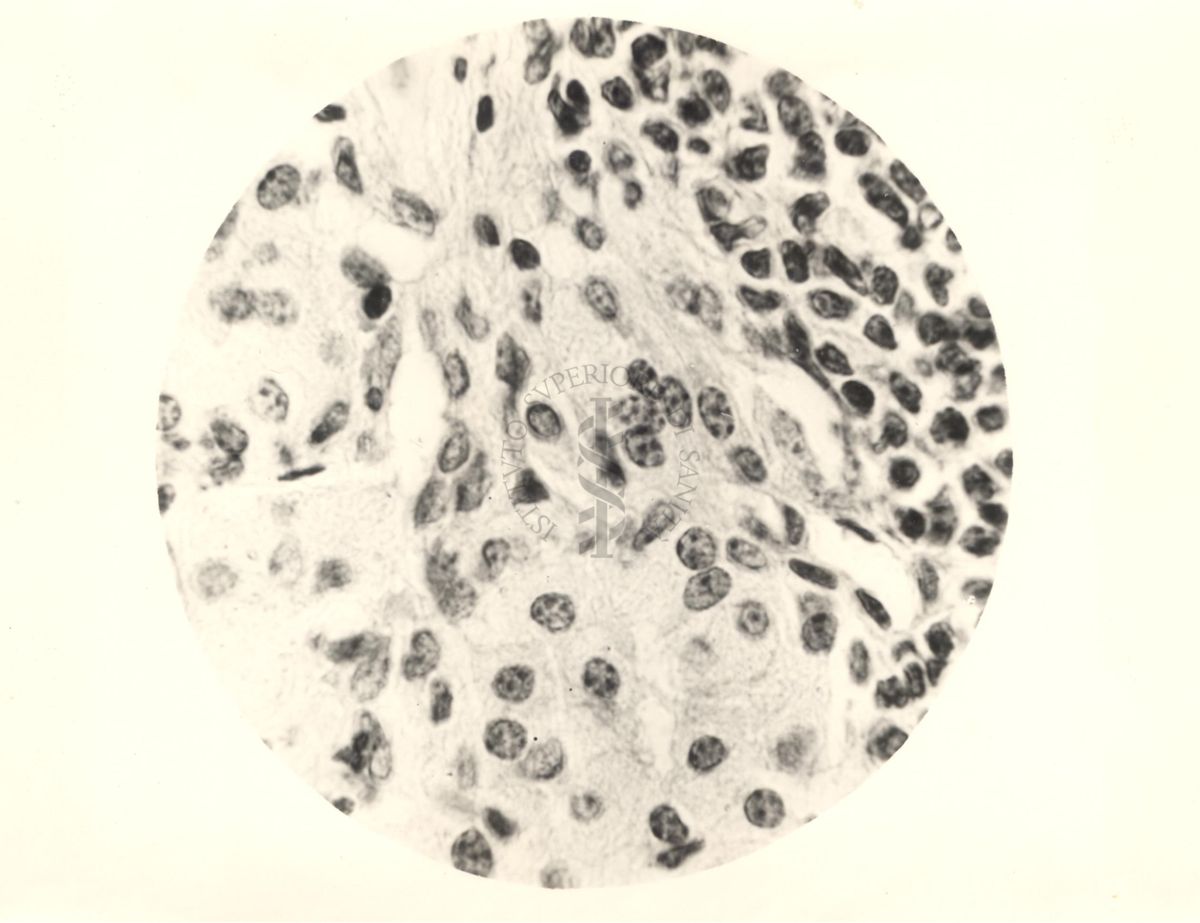 Organo di topo inoculato con tubercolina