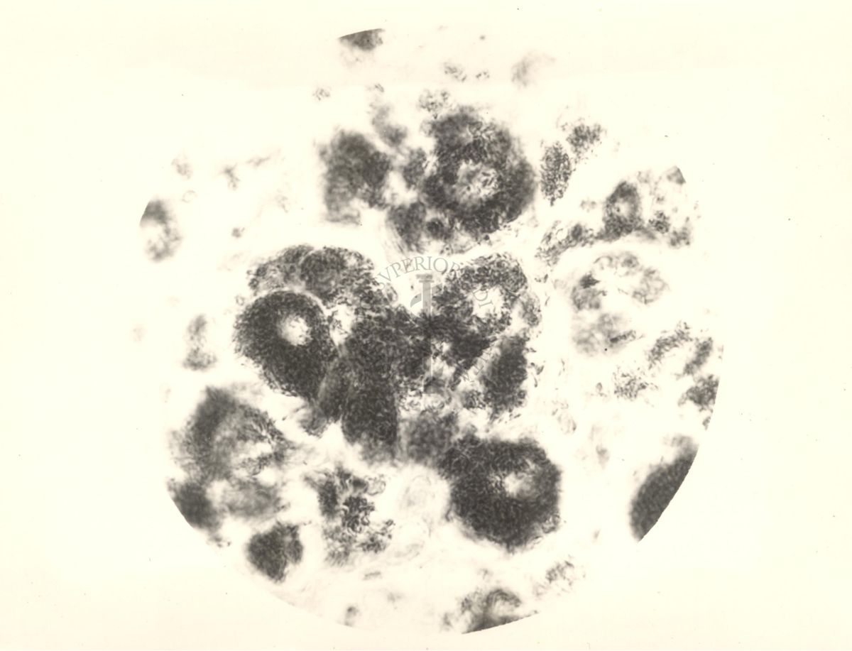 Organo di topo inoculato con tubercolina