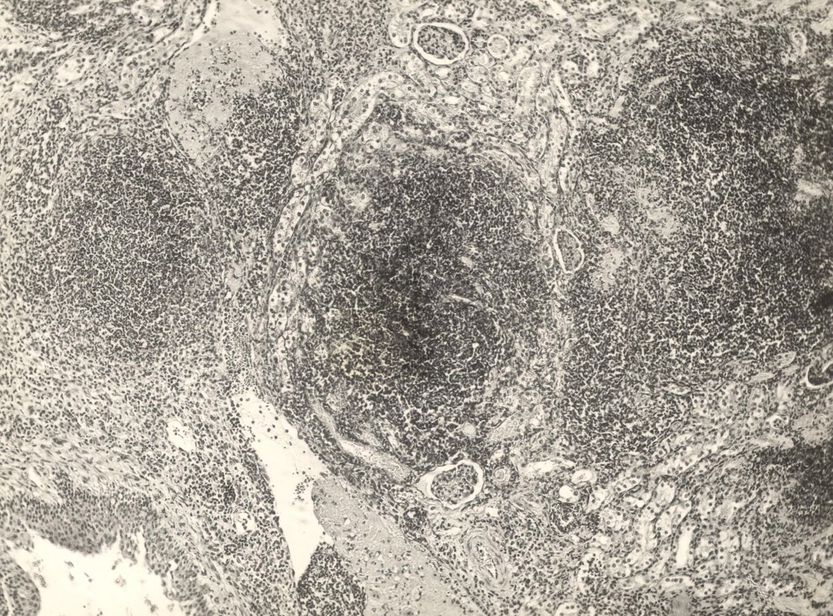 Organo di topo inoculato con tubercolina