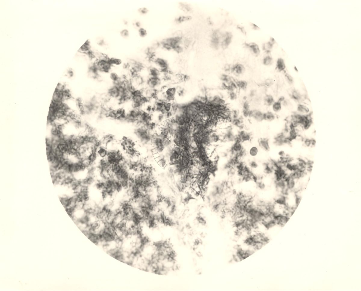 Organo di topo inoculato con tubercolina