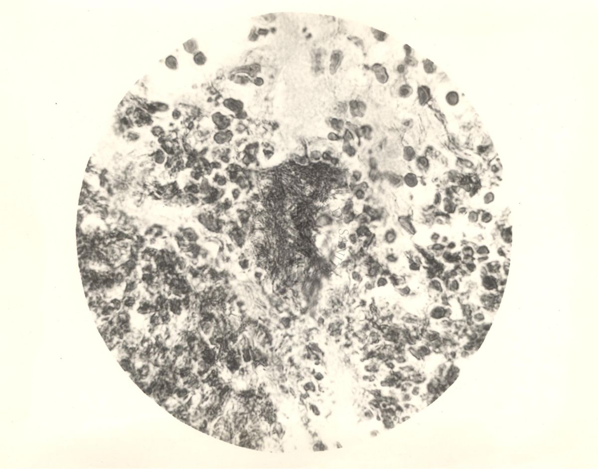 Organo di topo inoculato con tubercolina