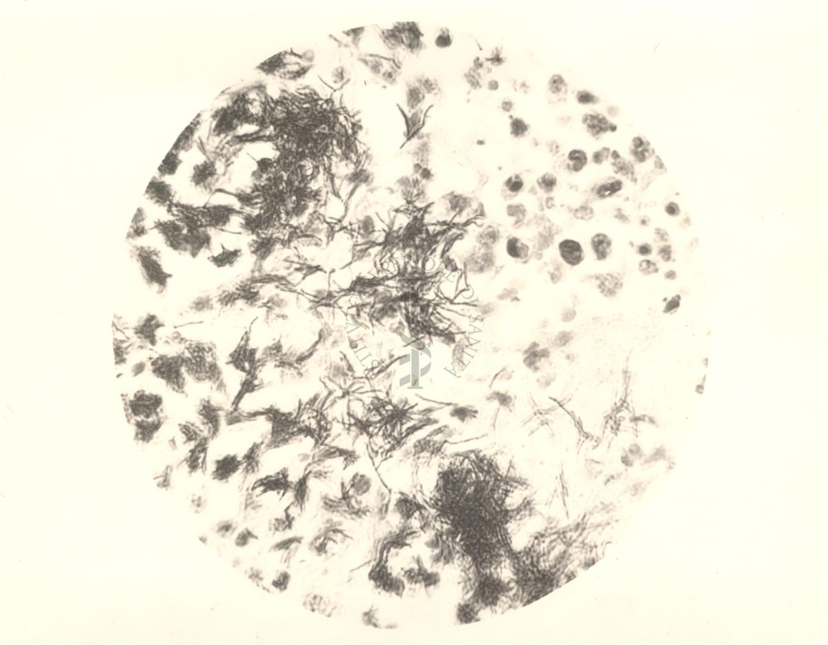 Organo di topo inoculato con tubercolina