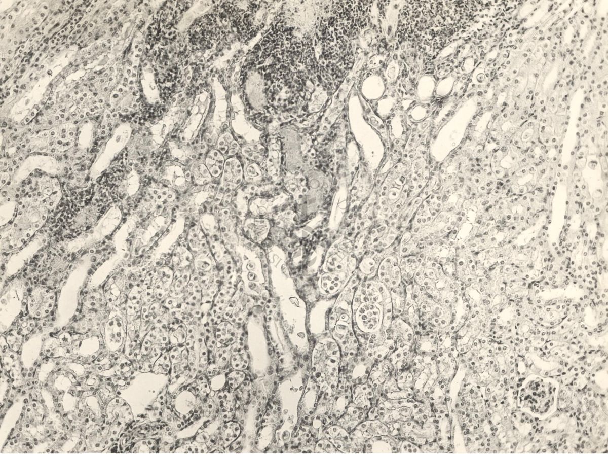 Organo di topo inoculato con tubercolina